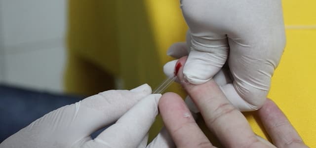 ‘Dia D’ realiza 180 testes rápidos no final de semana
